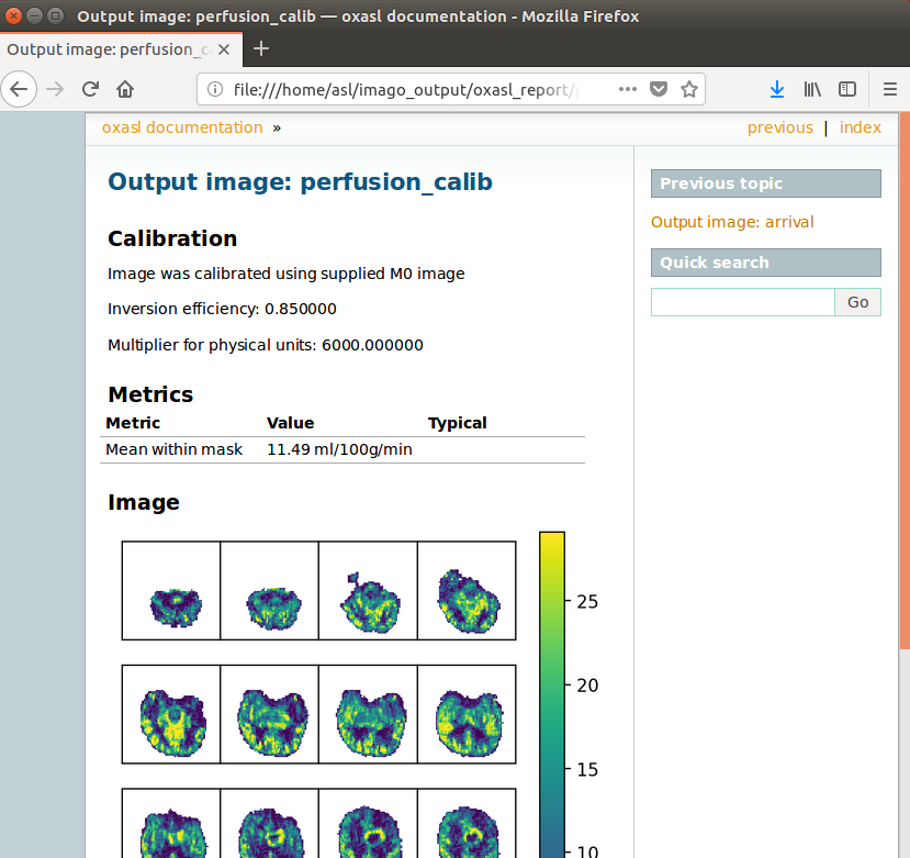 ../_images/imago_tutorial_report_perfusion.png